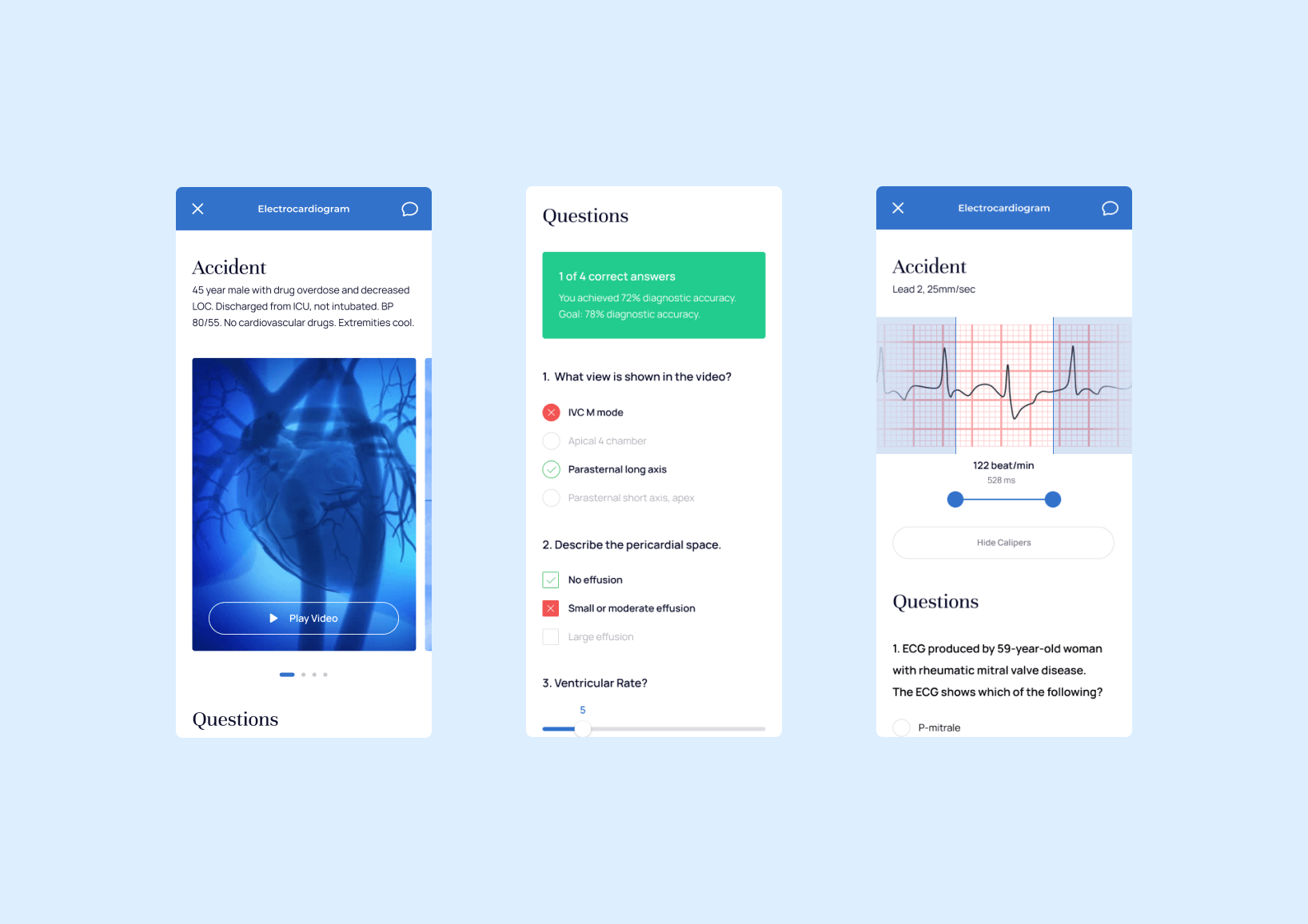 Tests in TM mobile app